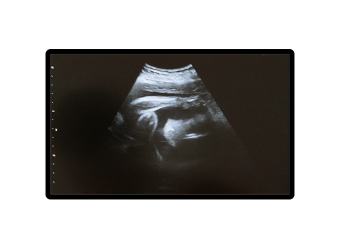 Ultrasound 27OLED_ F_700X480